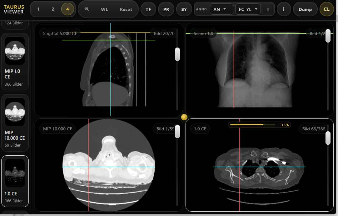 Screenshot des radiologischen Viewers